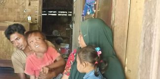 Bocah Penderita Kanker Ganas di Pandeglang Butuh Uluran Tangan