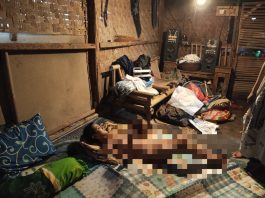 Kisah Haru di Pandeglang, Siti Anak Berkebutuhan Khusus Terbaring Sejak Bayi, BPJS Tak Aktif dan Belum Pernah Terima Bantuan