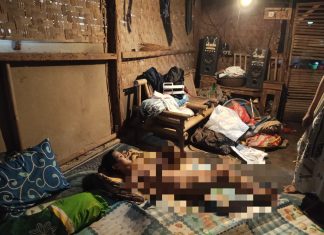 Kisah Haru di Pandeglang, Siti Anak Berkebutuhan Khusus Terbaring Sejak Bayi, BPJS Tak Aktif dan Belum Pernah Terima Bantuan