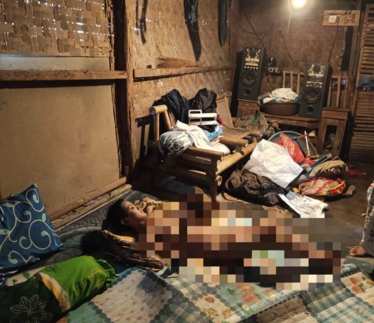 Kisah Haru di Pandeglang, Siti Anak Berkebutuhan Khusus Terbaring Sejak Bayi, BPJS Tak Aktif dan Belum Pernah Terima Bantuan